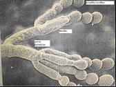 Μύκητες 4/4 Penicillium camemberti Penicillium camemberti x7500 Εμβολιασμός με επιφανειακό ψέκασμα του τυριού.