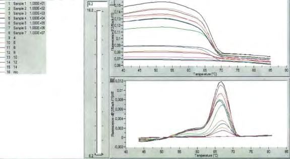 Εικόνα 7. Παράδειγμα αποτελεσμάτων RTPCR μετά την melting curve ανάλυση Στους 12-24 μήνες επανεξέτασης: οι 19/22 ασθενείς (86.