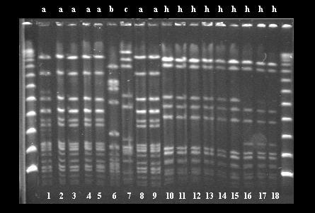 Ανάλυση με PFGE χρωμοσωμικού DNA μετά από επίδραση με SmaI Μονάδα νεογνών