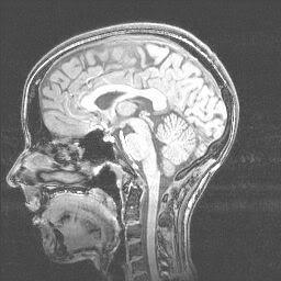Εικόνα 2: Ανατομική Απεικόνιση Εγκεφάλου Εικόνα 3: Λειτουργική με MRI Απεικόνιση Εγκεφάλου με MRI Η τεχνική του fmri βασίζεται στο γεγονός πως οι νευρώνες -όπως όλα τα κύτταρα του σώματός μας