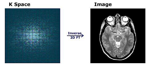Εικόνα 4: Μετατροπή Κ-χώρου σε 2D εικόνα 2.8 Διαδικασία λήψης εικόνων Ο τρόπος σχεδιασμού του πειράματος εξαρτάται από το ερευνητικό θέμα ή το ιατρικό πρόβλημα το οποίο μελετάται.