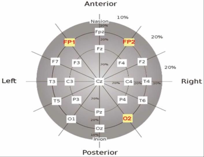 parietal, F = frontal, Fp =