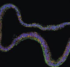 أواء على األبحاث هذا الشهر Nature Commun. http://doi. org/9wr (2015) على ا أ لشعة السة هذه م سحابة م ذرات هاك حاجة إلى لزر له طول موج أطول.
