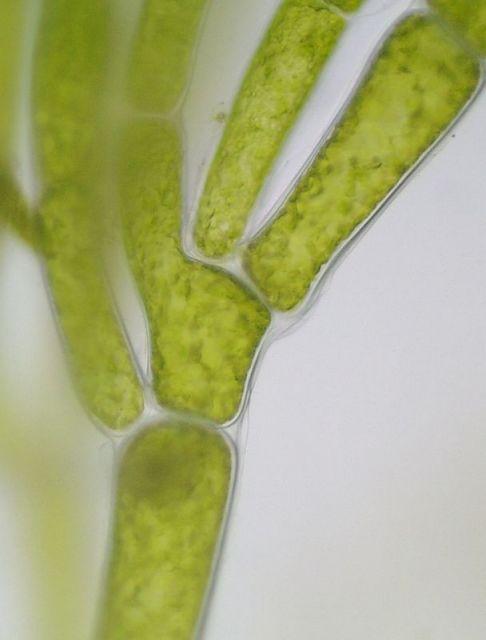 Predstavnici Chlorophyta mogu biti i nitaste, razgranate ili nerazgranate.