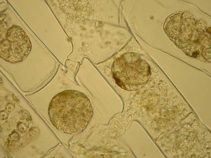 Spirogyra