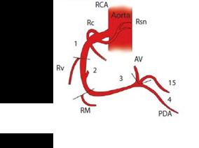o Other branches o Conus Artery o o RCA usually very proximal; (~50% have a separate origin)- courses