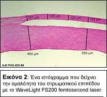 χρησιμοποιήσει. Η ομάδα μου και εγώ δουλεύουμε με το FS200 laser στην Αθήνα αφότου κέρδισε την πιστοποίηση της Ευρωπαϊκής Ένωσης (CE-mark). Το άρθρο αυτό περιγράφει λεπτομερώς το FS200 laser.