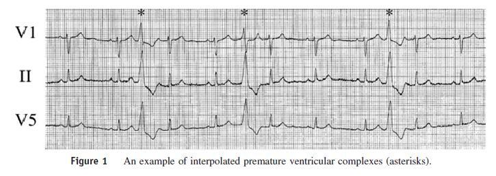 cardiomyopathy Proposed