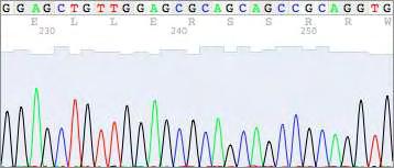 Η δεύτερη μετάλλαξη αφορά στο 18 ο εξόνιο του γονιδίου.