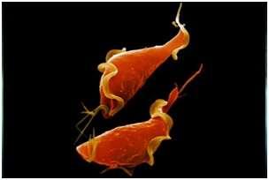 2. Τριχομοναδική κολπίτιδα (τριχομανάδωση ή τριχομονίαση) Πρόκειται για μονοκυτταρικό παράσιτο, το οποίο ζει και αναπαράγεται στον κόλπο ή την ουρήθρα. Επηρεάζει τόσο τους άνδρες όσο και τις γυναίκες.