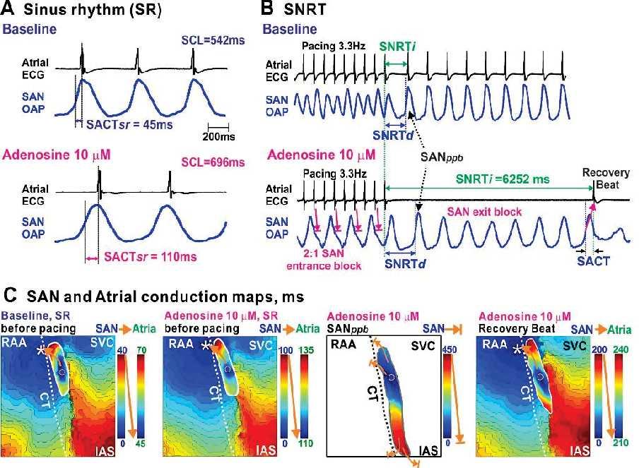 Lou et al.: Adenosine and SAN dysfunction in HF Circulation.