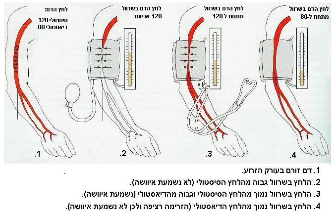 משחררים באיטיות את לחץ האוויר שבשרוול, ומיד לאחר שלחץ זה יורד מתחת ללחץ הדם הסיסטולי שבעורק, מצליח הדם לפרוץ את החסימה שיצר השרוול, וכל פעימה של הלב גורמת לפרץ של דם דרך העורק )יש לזכור כי לחץ הדם