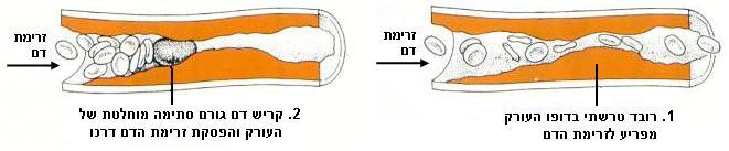 בסעיף העוסק בגורמי הסיכון למחלות לב צוין כי היעדר פעילות גופנית מעלה את הסיכון ללקות בטרשת עורקים, אך תרומתה של פעילות גופנית להקטנת הסיכון ללקות במחלות לב עשויה להיות רחבה בהרבה, וקשורה בתהליכים