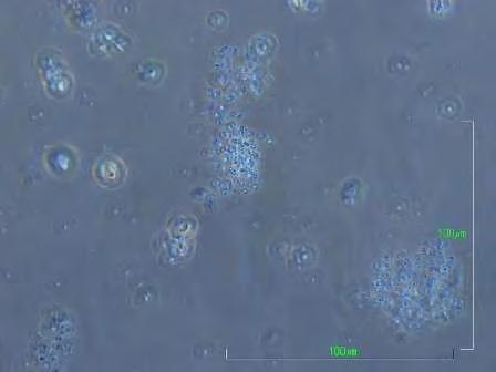 29 Τάξη Chroococcales Aphanothece sp. Τα είδη κυανοβακτηρίων που ανήκουν στο γένος Aphanothece έχουν συνήθως μπλε-πράσινο χρώμα.