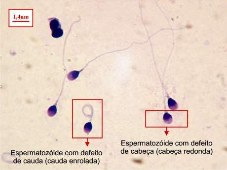 Sperm Morphology Evaluation by the Strict Criteria Head width 2.5 3.5 m Head length 5.0 6.