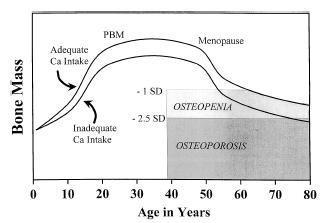 Ilich and Kerstetter, 2000 J ournal