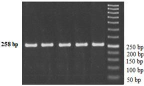 ارتباط بین جهش ژن بیان پردنین بتادفنسین -126 با... مارال رستمی ایجان همکاران شکل 1.