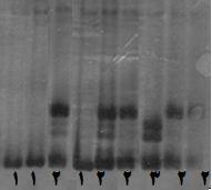 استفاده از محصلات اکنش SSCP صرت میگیرد. مطالعه حاضر بررسی PCR براي محصلات ژنمی ناحیه PCR اگزن 2 بارر شاهد 40 بیمار 35 ژن از باندهاي متفاتی را نشان داد.