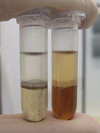 3.Organska ekstrakcija - organski rastvarač fenol, koristi se za deproteinizaciju uzoraka fenol, hloroform ili fenol : hloroform, Fenol : hloroform : izoamilalkohol Kiseli ili neutralni fenol utiču