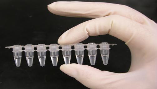 PCR(engl. Polymerase Chain Reaction) Lančana reakcija polimeraze metoda kojom se za kratko vreme može dobiti ogroman broj kopija nekog fragmenta DNK, bilo kog porekla.