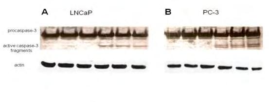 74 Κασπάση LNCaP & Κασπάση 120,00% 100,00% Relative Intensity % 80,00% 60,00% 40,00% 20,00% 0,00% CTL BBS END Bor Bor+BBS Bor+END PC3 & Κασπάση 120,00% 100,00% Relative Intensity % 80,00% 60,00%