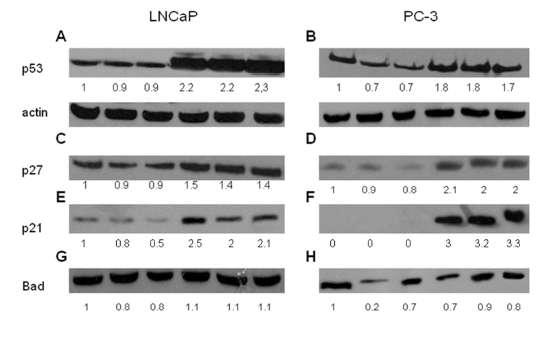 76 p53, p27 p21,bad Εικόνα 18. Ανάλυση western blotting πρωτεϊνικών δειγμάτων κυττάρων LNCaP (αριστερή στήλη) και PC3 (δεξιά στήλη) με αντισώματα κατά των πρωτεϊνών p53, p27, p21 και Bad.