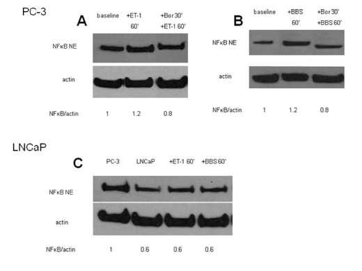 84 Η μετατόπιση του NFκB στον πυρήνα από τα νευροπεπτίδια μπλοκάρεται από την μπορτεζομίμπη στη PC3 κυτταροσειρά.