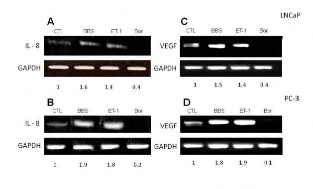 86 Η διαφορετική επίδραση των νευροπεπτιδίων, βομβεσίνη και ET-1, και του αναστολέα του πρωτεασώματος, μπορτεζομίμπη, στην έκφραση των γονιδίων στόχων του NFkB, IL-8 και VEGF.