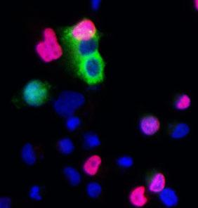 (B) Western blot examining Ptpn14 levels