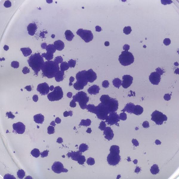 Ptpn14 displays tumor suppressor activity (A) qrt-pcr to examine