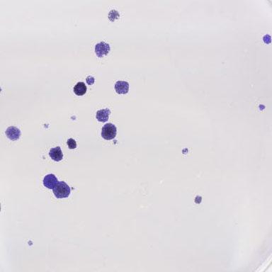 Colorectal (HCT116 p53 WT and HCT116 p53 KO), pancreatic (CAPAN2-p53 WT and MIA PaCa-2-p53 MUT), lung (A549-p53 WT and H1299-p53 MUT) and breast (MCF7-p53 WT and MDA-MB-231-p53 MUT) cancer cells were