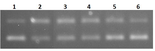 1. 1 µg πλασµιδίου αρνητικός µάρτυρας 2. 1 µg πλασµιδίου + 1.667 units ενζύµου θετικός µάρτυρας 3. 1 µg πλασµιδίου + 1.667 units ενζύµου + ΑΣ (2.5 µg/ml) 4. 1 µg πλασµιδίου + 1.667 units ενζύµου + ΑΣ (5 µg/ml) 5.
