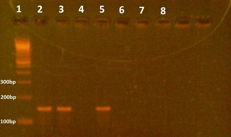 Απεικόνιση της ηλεκτροφόρησης της PCR για τον αρνητικό κλώνο (απομόνωση των 12h).