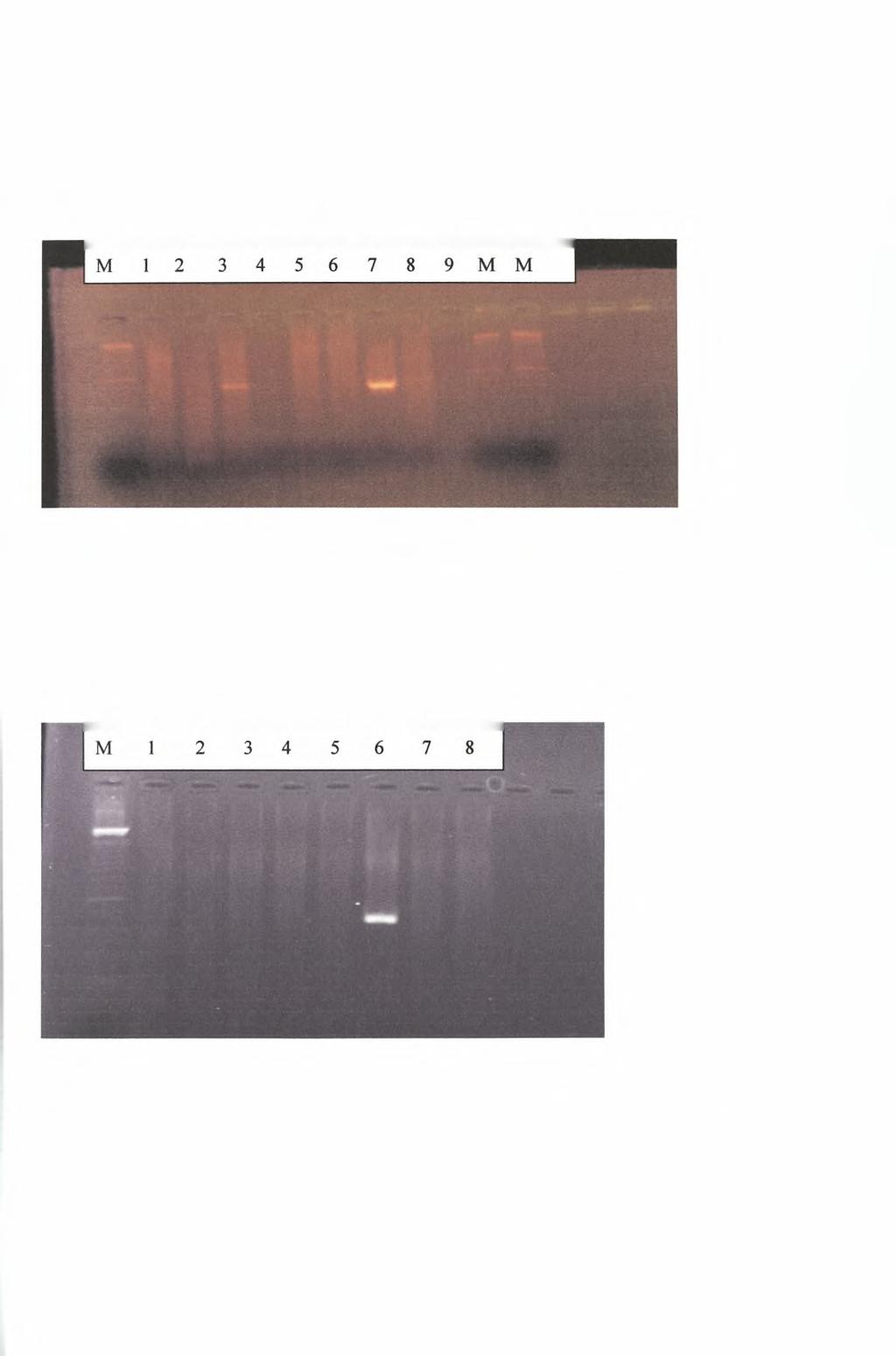 Εικόνα 12 : Ηλεκτροφόρηση προϊόντων sn PCR με ζεύγος εκκινητικών μορίων τα TS1- HEVC9. Ως Μ σημειώνεται μάρτυρας γνωστού μοριακού βάρους.