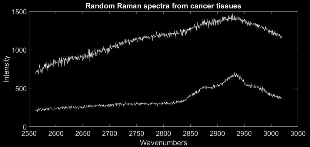 δμηζιαζηζηέξ) ζηα 1500 ηαζ 1000 cm -1. Healthy tissue Cancer tissue (Εηθόλα 3.5.3) Από ιζα πνώηδ ιαηζά αθέπμοιε πςξ ηα θάζιαηα ιμζάγμοκ πμθύ ζηα αζαθζμβναθζηά ακ ηαζ ημ ζήια είκαζ πεζνόηενμ.