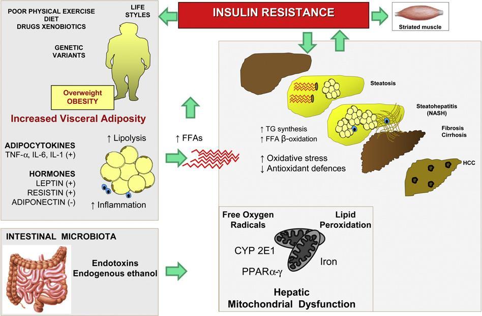 ΠΑΙΟΓΕΝΕΗ ΣΗ NAFLD Η ινςουλινοαντοχό εύναι ο κύριοσ μηχανιςμόσ που οδηγεύ ςτην ηπατικό ςτεϊτωςη Για την ανϊπτυξη φλεγμονόσ πιθανώσ