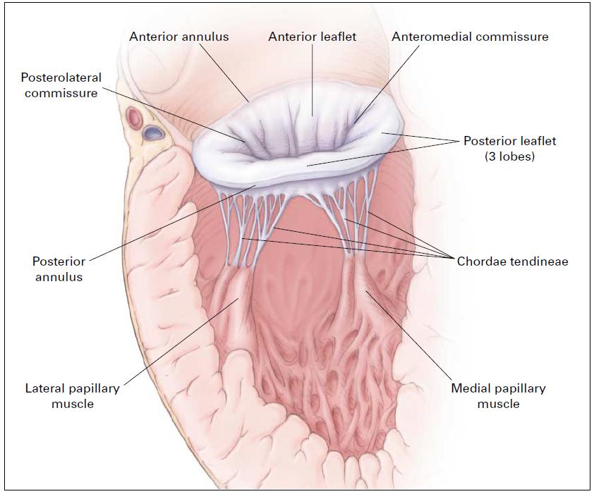 Causes of Mitral regurgitation Ø Ø Ø Ø Ø Ø Annulus Calcification Endocarditis (abcess) Valvular-leaflets Myxomatous MV Disease Rheumatic Endocarditis Congenital-clefts Chordae