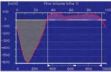 שיטת Phase contrast מאפשרת מדידה כמותית )במל"ל לדקה( של זרימת דם בכלי דם ודרך מסתמים, ומאפשרת מדידת מפלי לחצים דרך היצרויות בכלי דם ומסתמים וכימות מדויק של אי-ספיקה מסתמית.