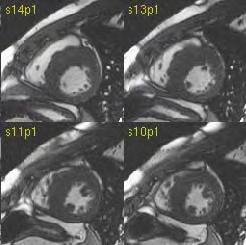 CVMRI יכולה לשמש כחלופה הולמת לבדיקות פולשנית או לבדיקות הכרוכות בקרינה מייננת, ברשימה מתארכת של הוריות ומצבים בקרדיולוגיה.