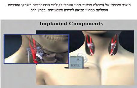 שינויים רבים בתקינות קשת הברורפלקס נמצאו בחולים עם יתר לחץ דם כרוני. אחד הדברים הראשונים שקורים ביתר לחץ דם כרוני, הוא עליית נקודת האיזון שאליה הברורפלקס שואף להביא את לחץ הדם.