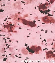 Streptococcus agalactiae ulazi kroz otvore na sisnim kanalima Kada se nađe u mlijeku inficiranih krava, može kontaminirati sve sa čime mlijeko dolazi u dodir,
