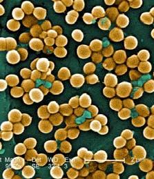 Staphylococcus aureus U početku antibiotske ere bio je osjetljiv prema penicilinu, postupno su se javili rezistentni sojevi, jer su u stadima počeli