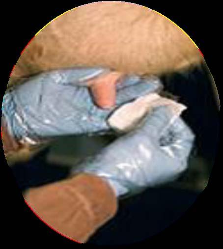 dezinfekcijskim rupčićem Skinuti zaštitnu kapicu injektora i kroz sisni kanal
