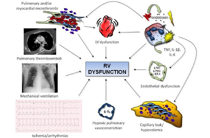 Mechanisms of RV Dysfunction in