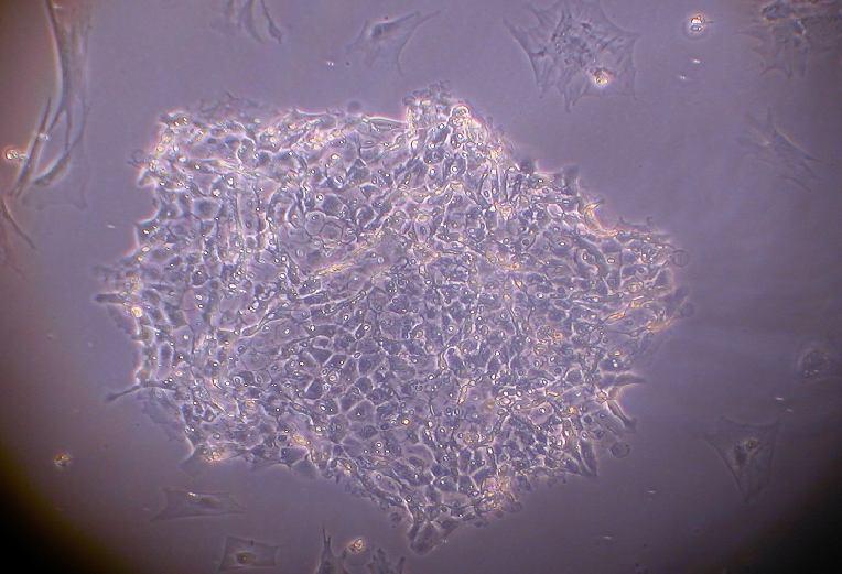 Τα κύτταρα άρχισαν να σχηματίζουν σφαιρικές δομές παρόμοιες με αυτές που παρατηρούνται κατά την καλλιέργεια εμβρυϊκών κυττάρων (Εικόνες