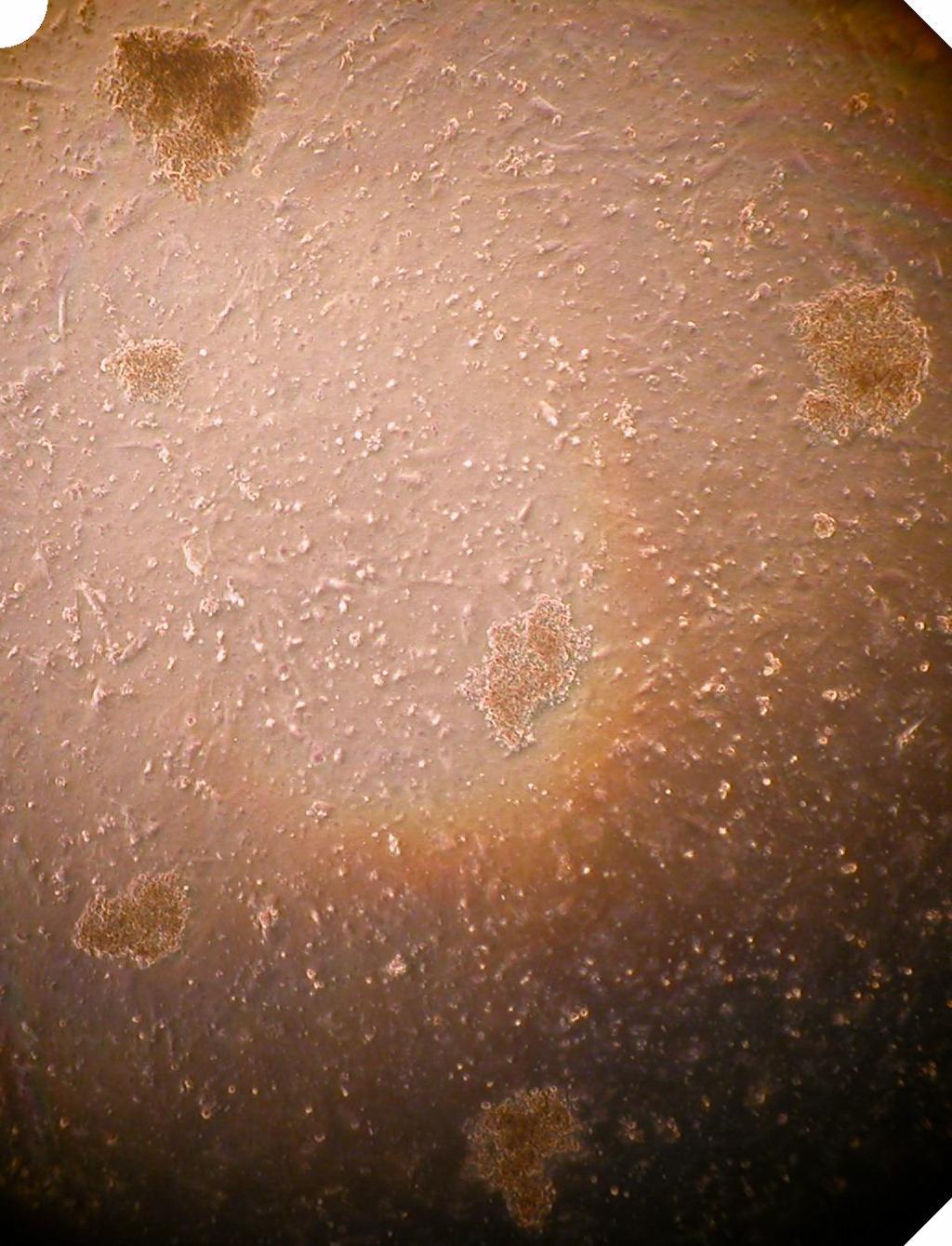 119 Εικόνες 30-31. Σχηματισμός σφαιρών από τα πολυδύναμα εμβρυϊκά κύτταρα, όταν στη καλλιέργεια χρησιμοποιούνται σαν στρωματικά κύτταρα μεσεγχυματικά κύτταρα από τον ιστό του ομφάλιου λώρου.
