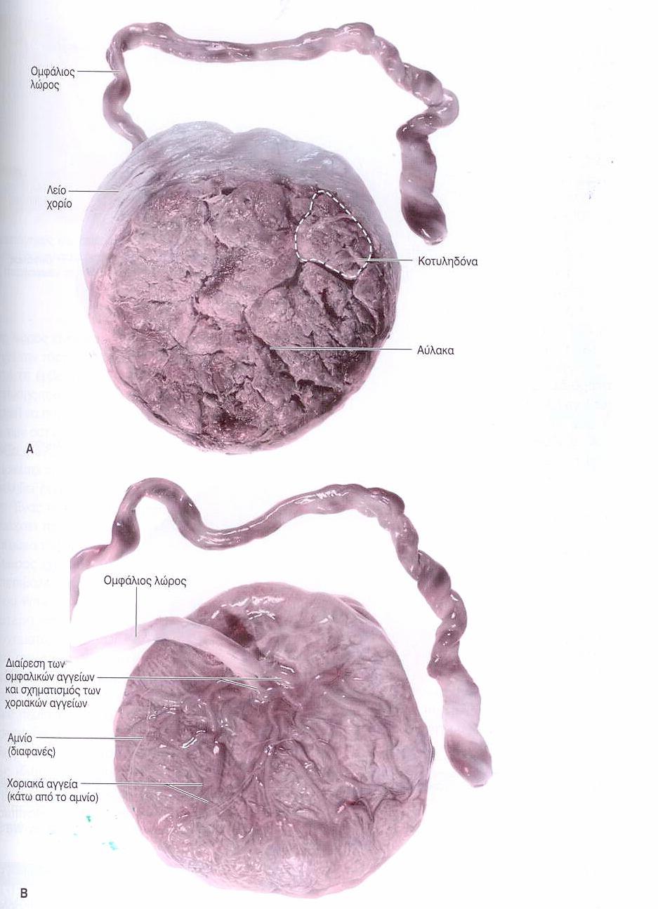 Εικόνα 2. Πλακούντες και εμβρυϊκές μεμβράνες μετά τη γέννηση. Α. Μητρική επιφάνεια με τις κοτυληδόνες και τις αύλακες γύρω από αυτές.