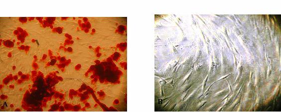 97 Εικόνα 11. Α Διαφοροποίηση των μεσεγχυματικών κυττάρων από τον πλακούντα σε οστικά κύτταρα. Η αλιζαρίνη χρωματίζει κόκκινες τις εναποθέσεις ασβεστίου των οστικών κυττάρων Β.