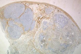 ( χόμα 25).