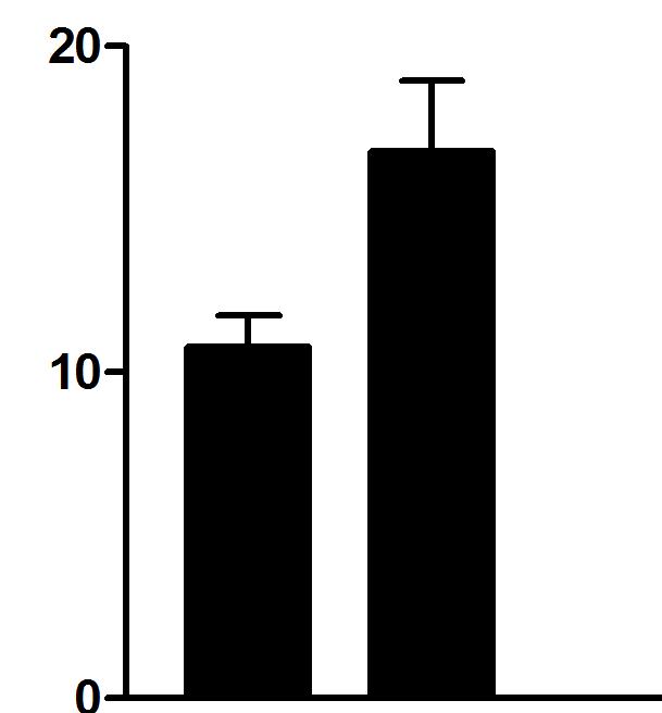 Microvessel Αξηζκόο αγγείωλ number Αποτελϋςματα 3.2.3. ΤΦΕΣΙΗ ΣΗ ΕΚΥΡΑΗ ΣΟΤ CD44 ΣΟ ΣΡΨΜΑ ΣΟΤ ΟΓΚΟΤ ΜΕ ΣΗΝ ΑΓΓΕΙΟΓΕΝΕΗ Η ϋκφραςη του CD44 ςτο ςτρϔμα του ϐγκου ςυςχετύςτηκε με τον αριθμϐ των αγγεύων.